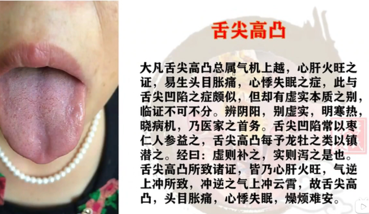 舌尖高凸