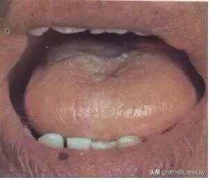 中医大师六十年舌诊经验总结