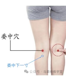 【中医故事会】解决急性腰扭伤